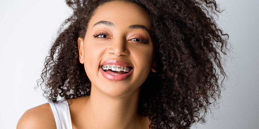 Conventional orthodontic treatment North Vancouver