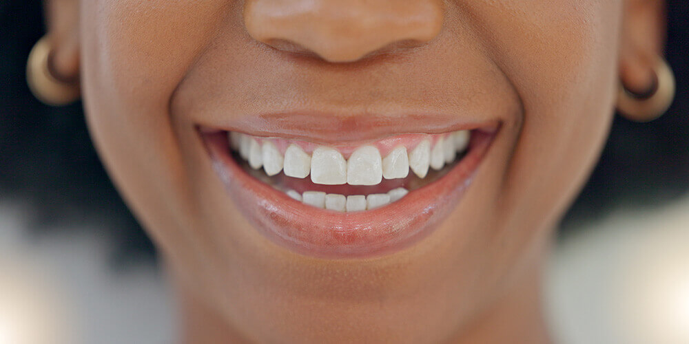 Gum restorative surgeries North Vancouver