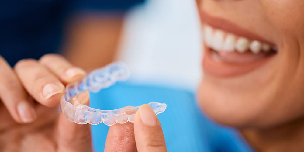 Night guard North Vancouver