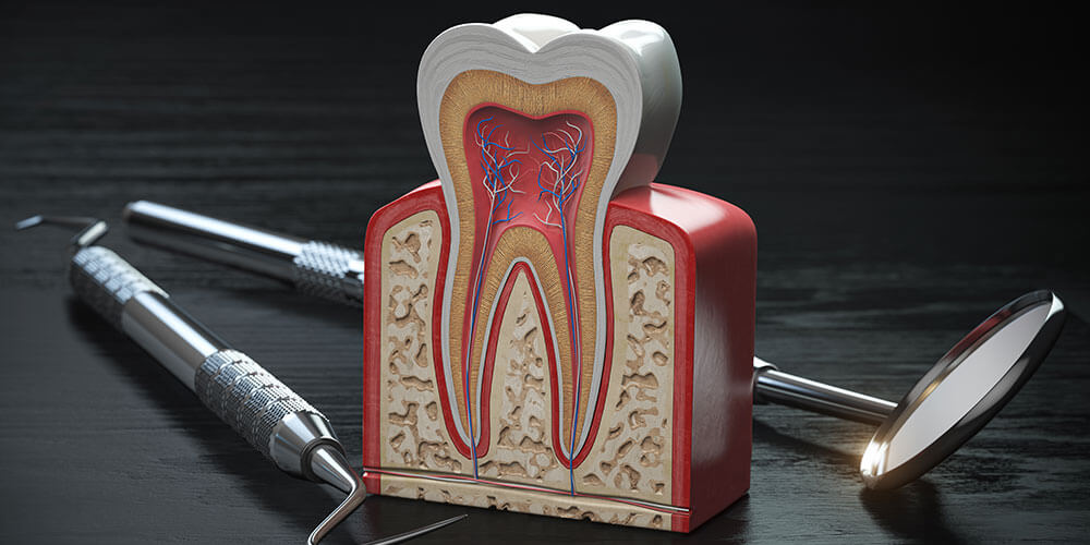 Non surgical root canal therapy North Vancouver