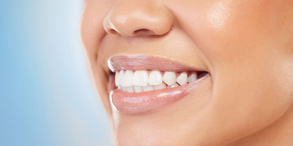 Polish and Fluoride North Vancouver