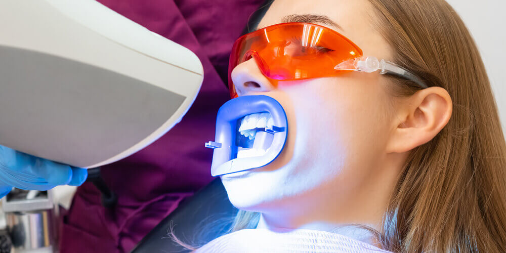 Whitening North Vancouver